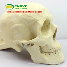 TF09 (12320) Modelo de Prática de Cirurgia de Reparo de Crânio para Educação Médica